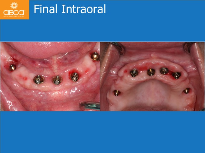 Clinical Case
