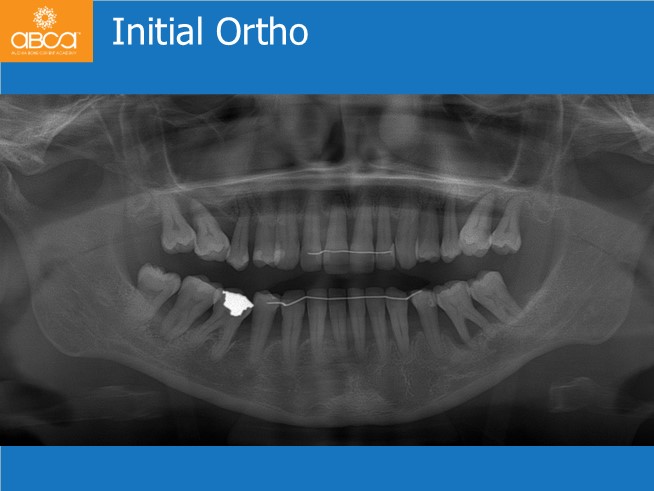 Clinical Case