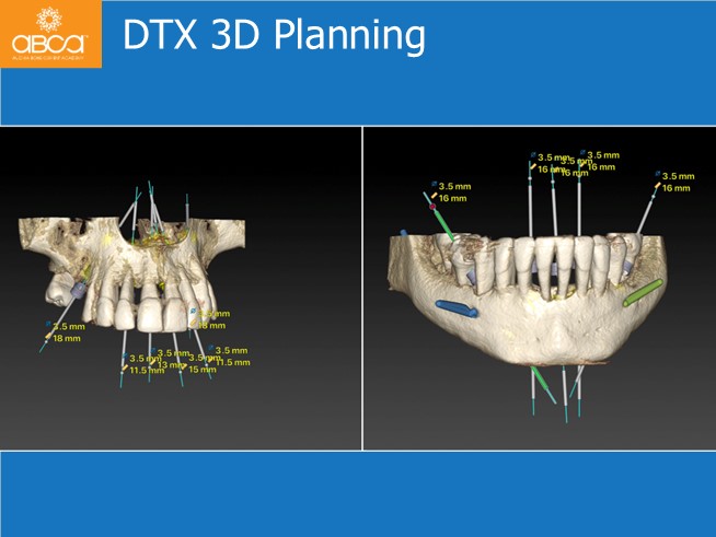 Clinical Case
