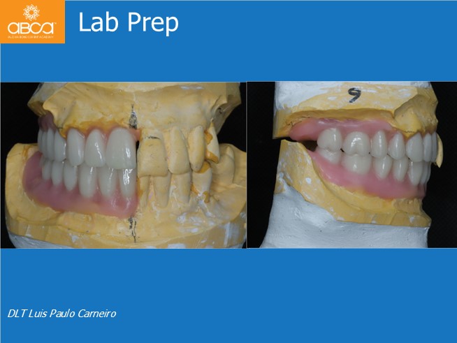 Clinical Case