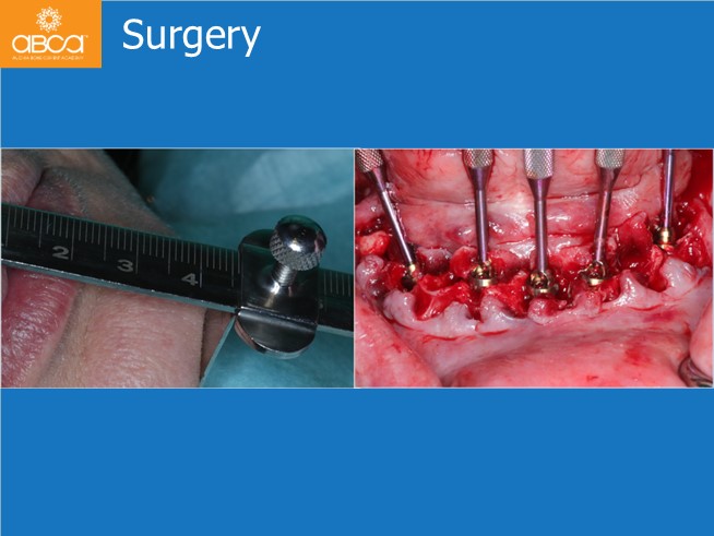 Clinical Case