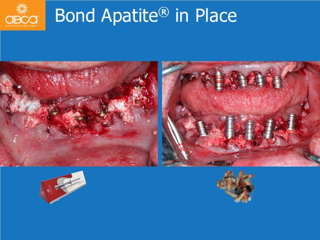 Clinical Case