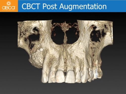 Clinical Case