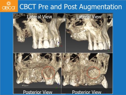 Clinical Case