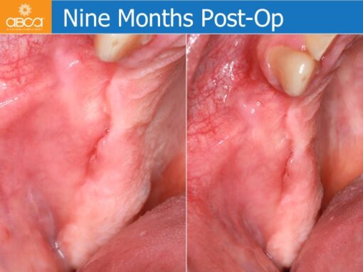 Clinical Case