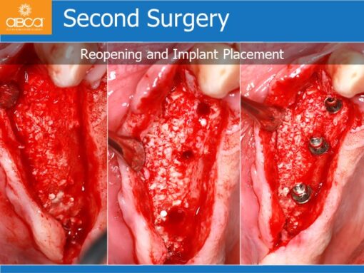 Clinical Case