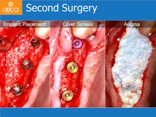 Clinical Case