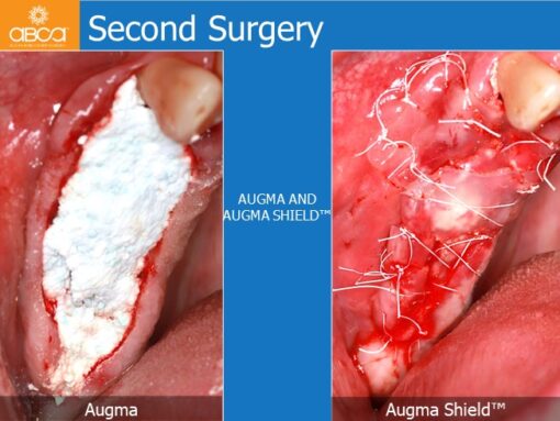 Clinical Case