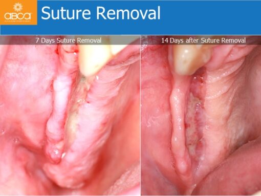 Clinical Case