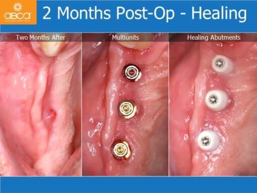 Clinical Case