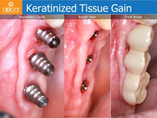 Clinical Case