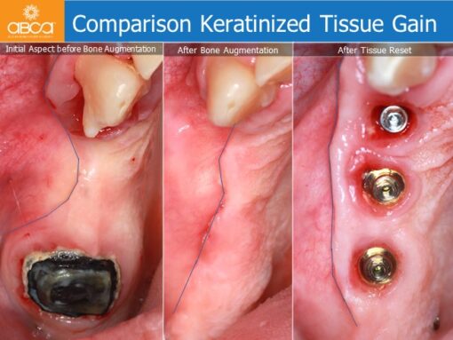 Clinical Case