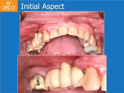 Clinical Case