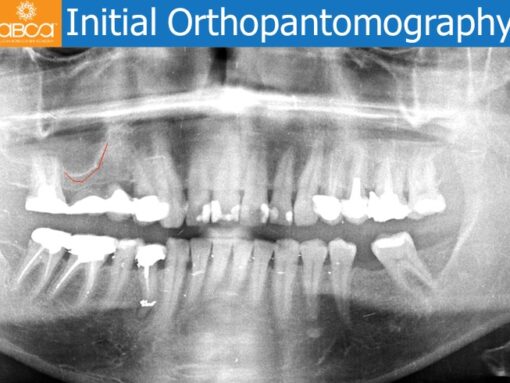 Clinical Case
