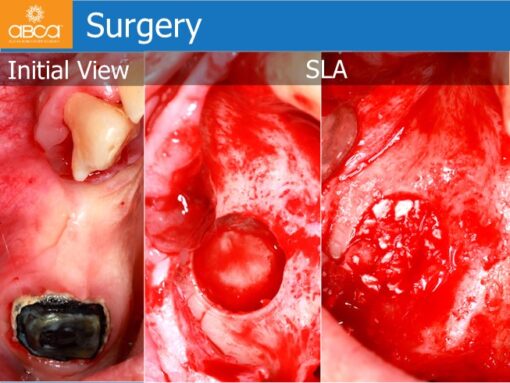 Clinical Case