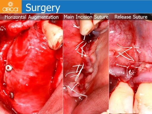 Clinical Case