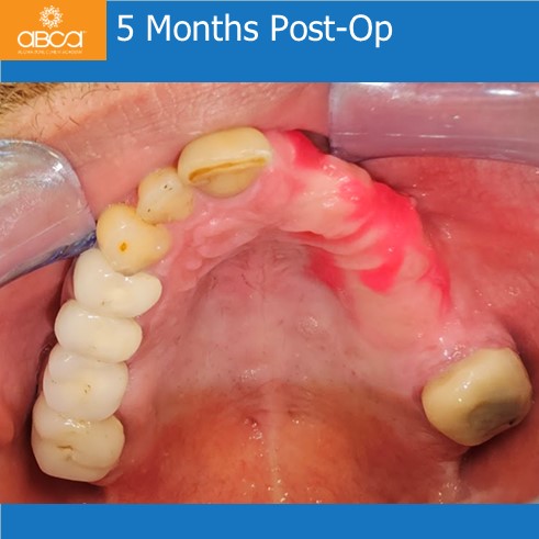 Clinical Case