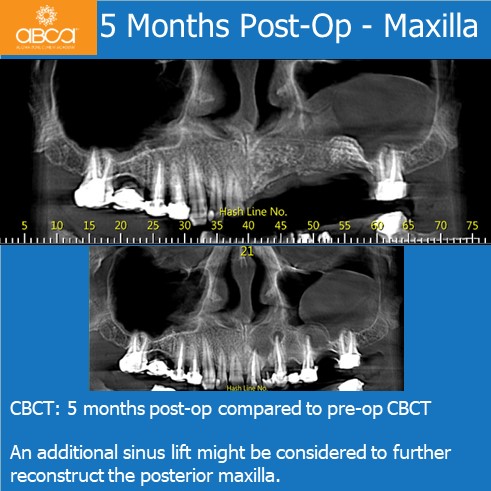 Clinical Case