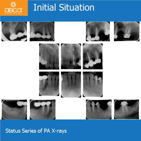 Clinical Case