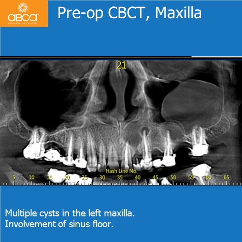 Clinical Case