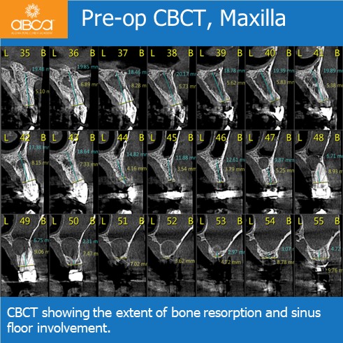 Clinical Case