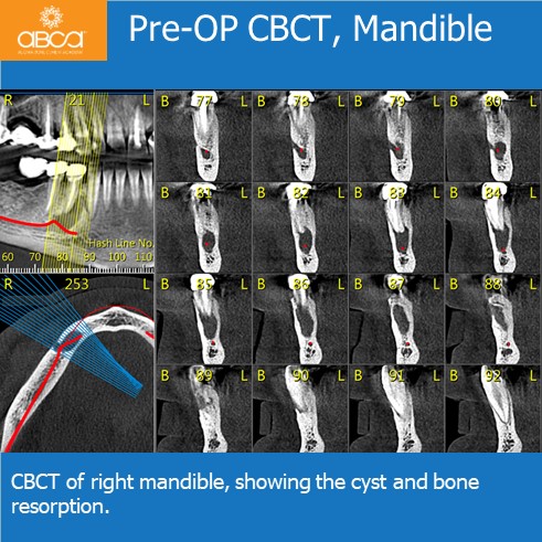 Clinical Case