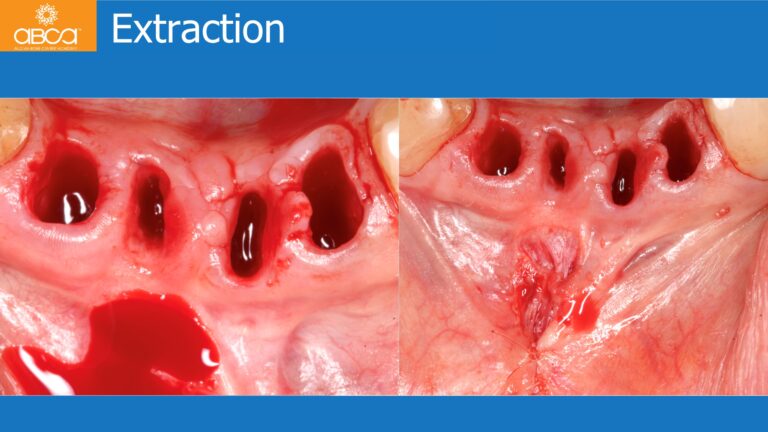 Clinical Case