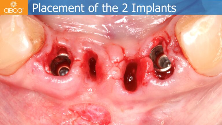 Clinical Case