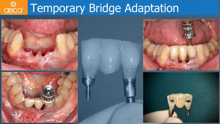 Clinical Case