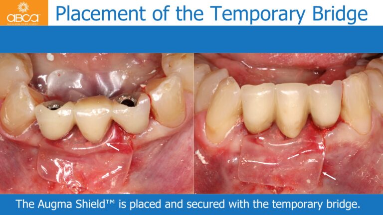 Clinical Case