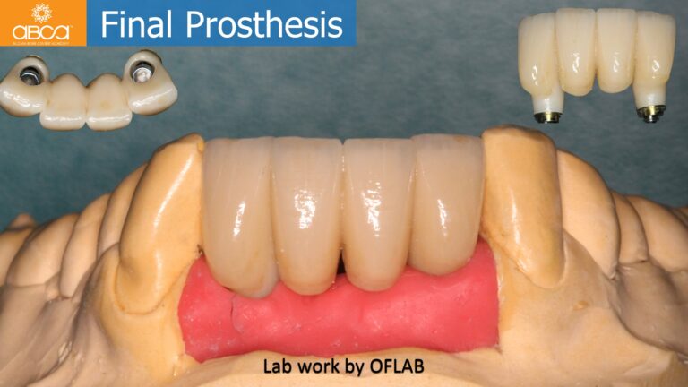 Clinical Case