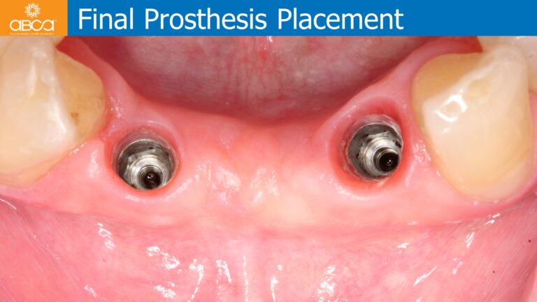 Clinical Case