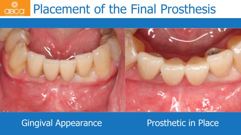 Clinical Case