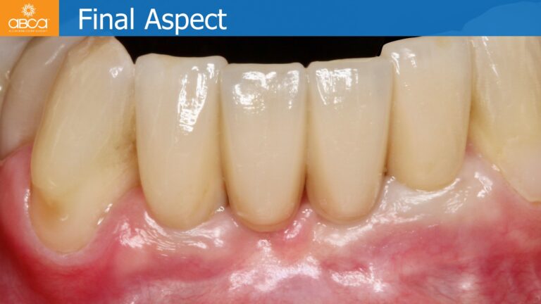 Clinical Case