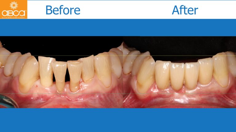 Clinical Case