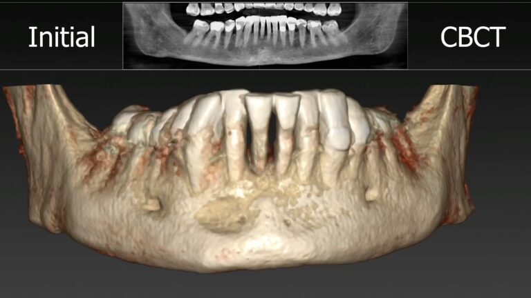 Clinical Case