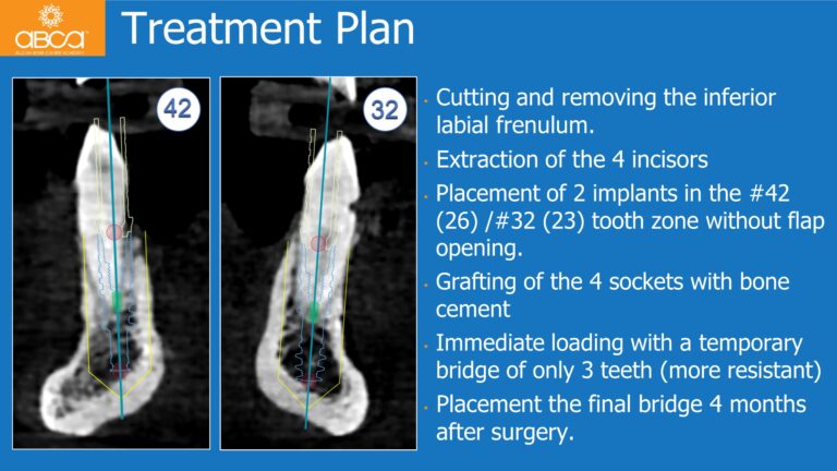 Clinical Case