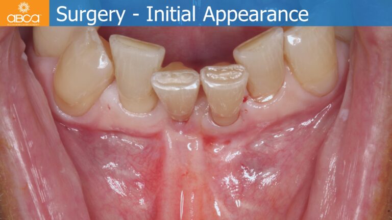 Clinical Case