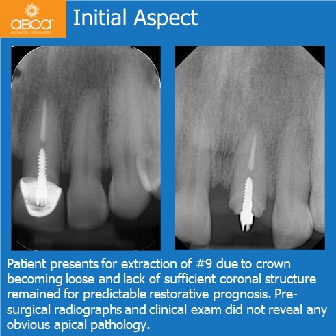 Clinical Case