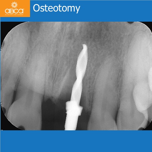 Clinical Case