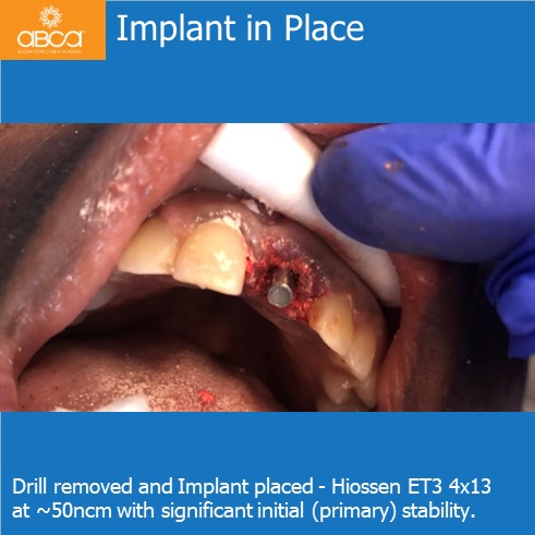 Clinical Case