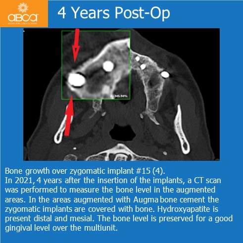 Clinical Case