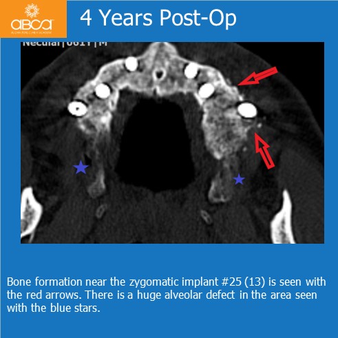 Clinical Case