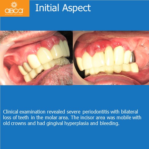 Clinical Case