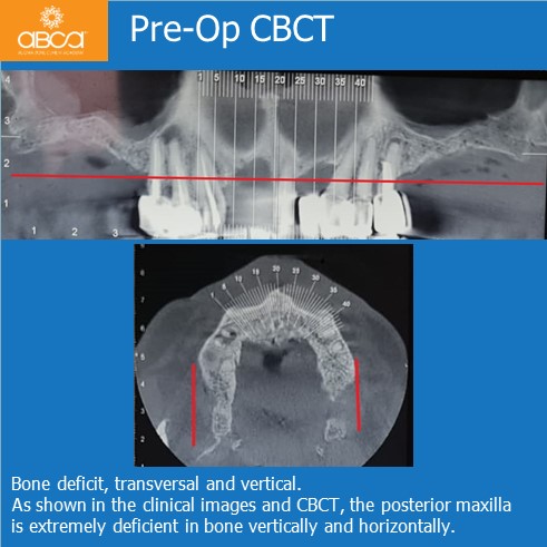 Clinical Case