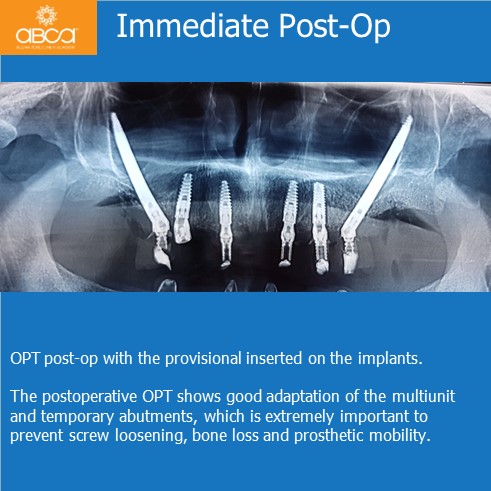 Clinical Case