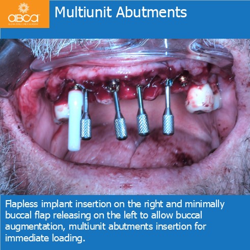 Clinical Case