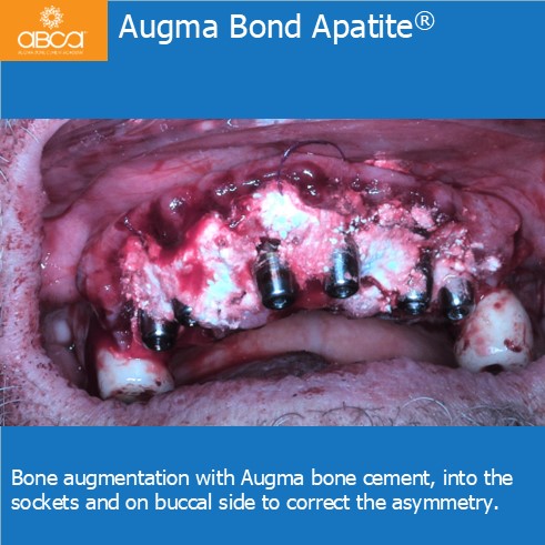 Clinical Case