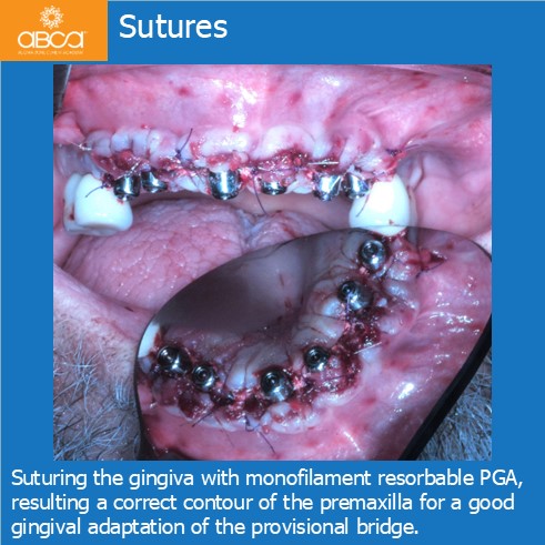 Clinical Case