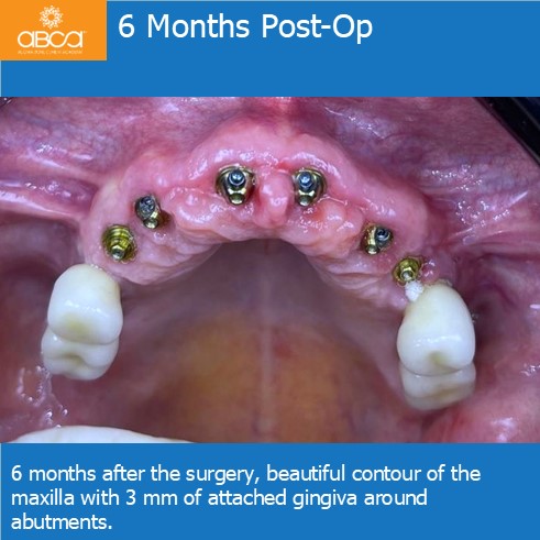 Clinical Case